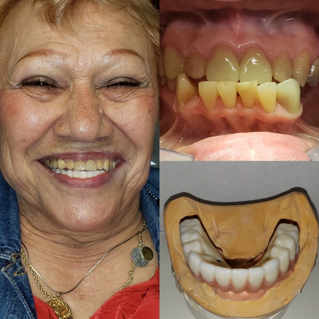 Before After Image