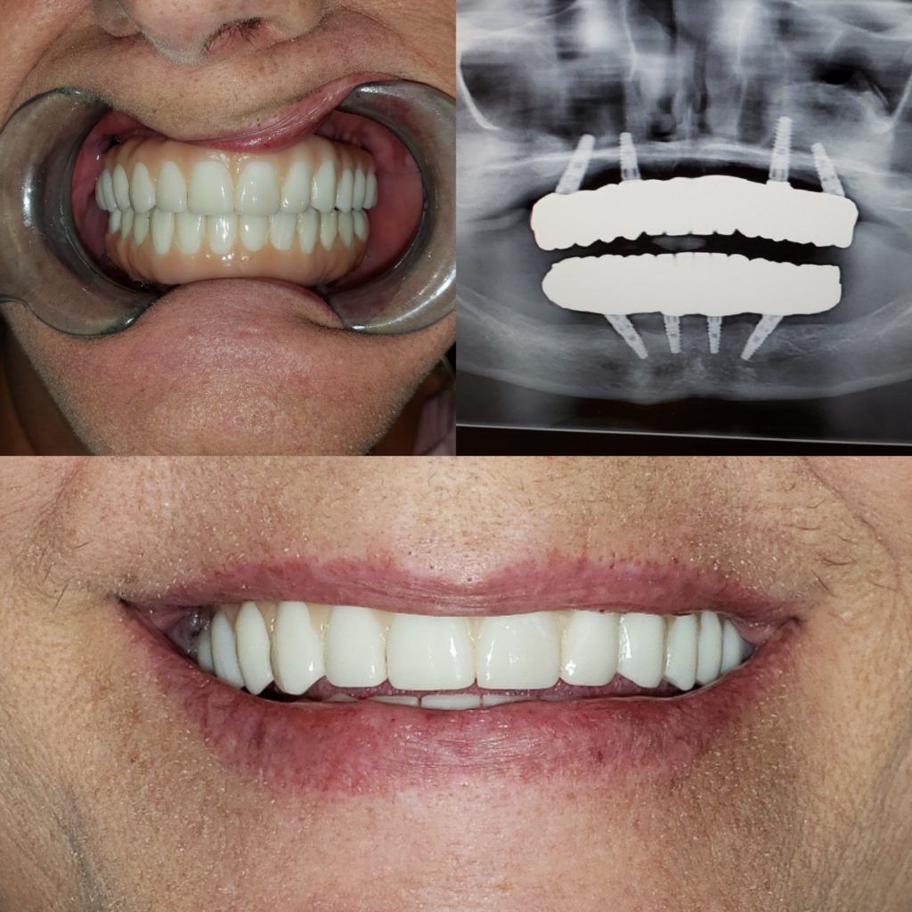Before After Image